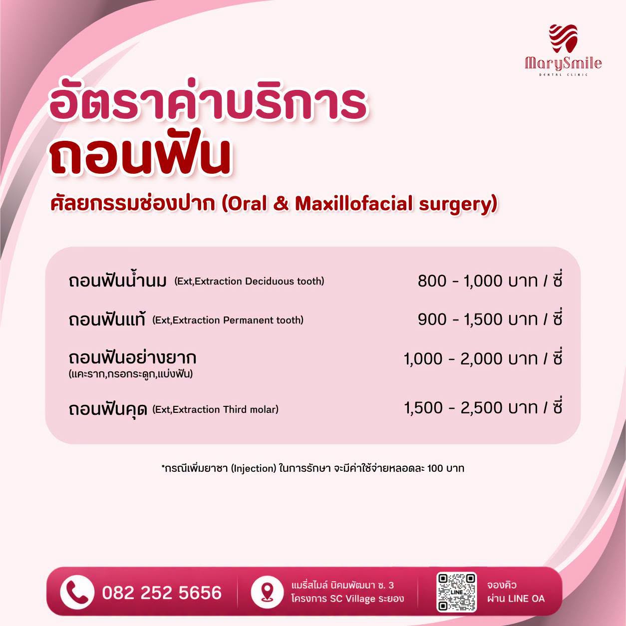 ถอนฟัน