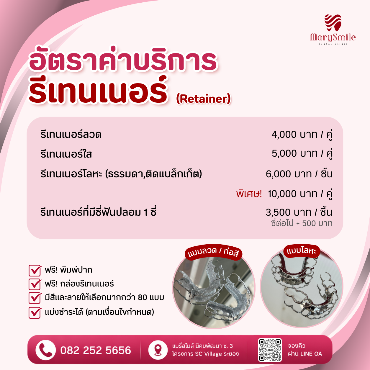 รีเทนเนอร์