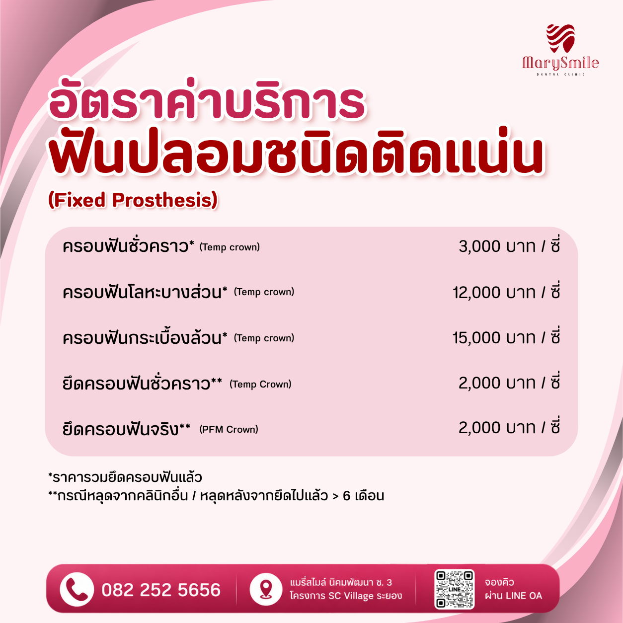 ฟันปลอมชนิดติดแน่น