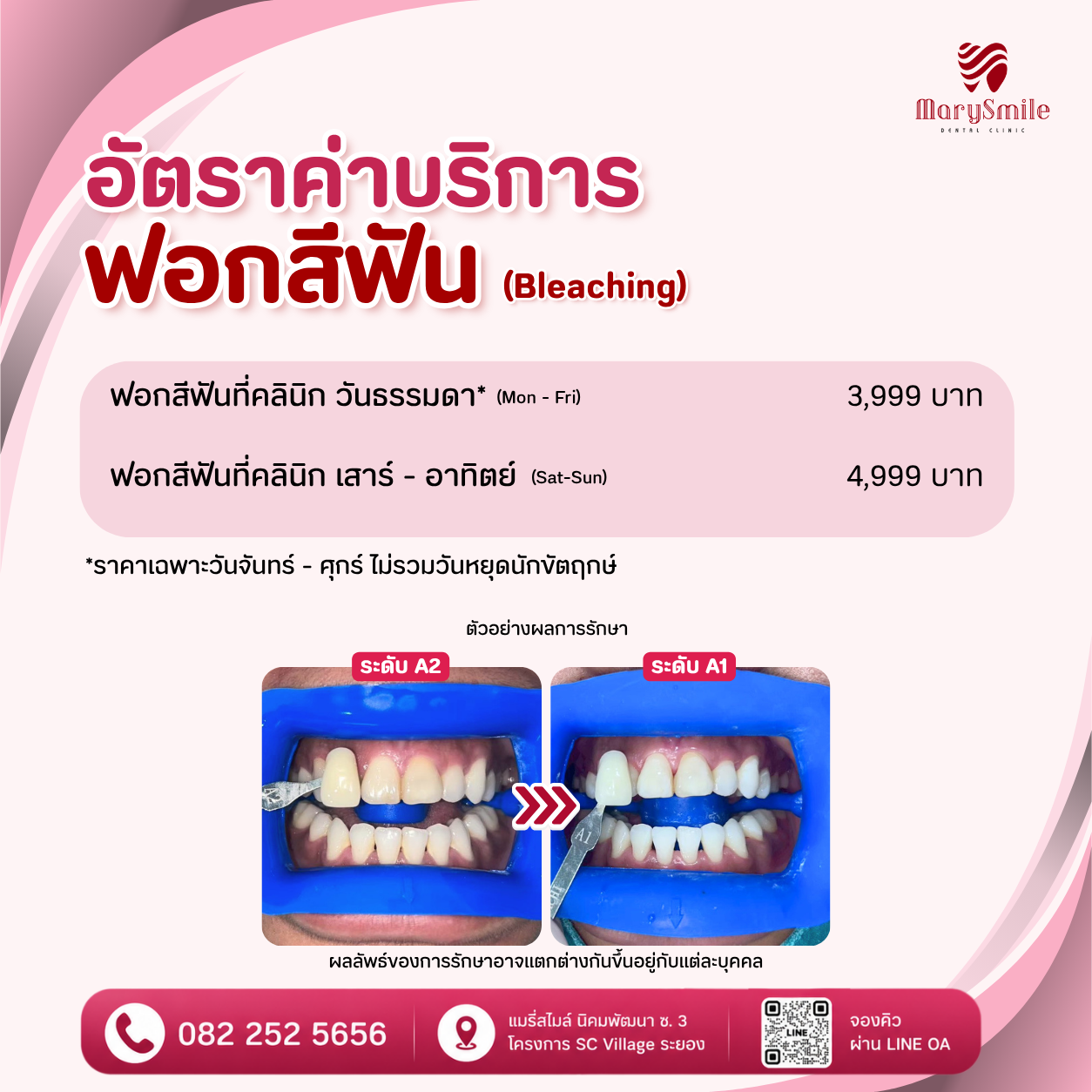 ฟอกสีฟัน