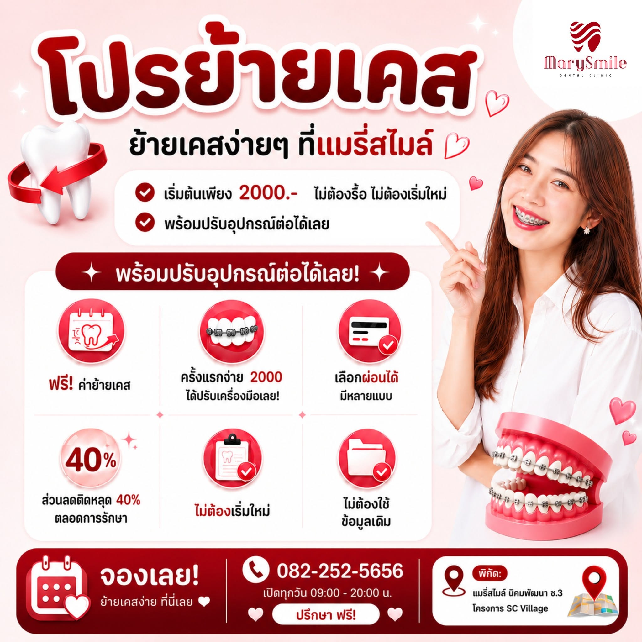 ย้ายเคสจัดฟันเริ่มต้น 2,000.-