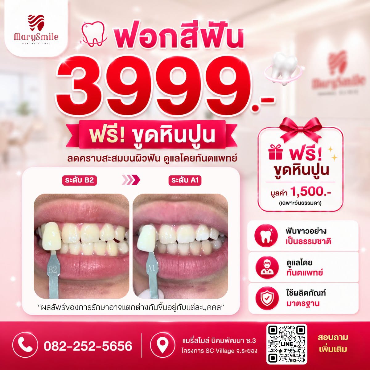 ฟอกสีฟัน 3999.-